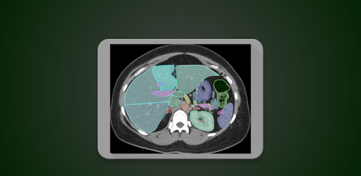 Radiology CT Anatomy PC screenshot