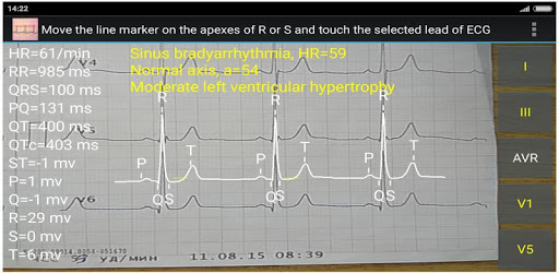 ECG Reader2 free PC screenshot