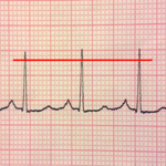 ECG Reader2 free icon