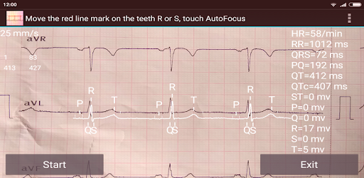 ECG Reader free PC screenshot