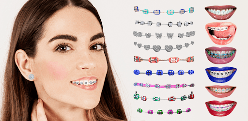 Braces 2018 PC screenshot