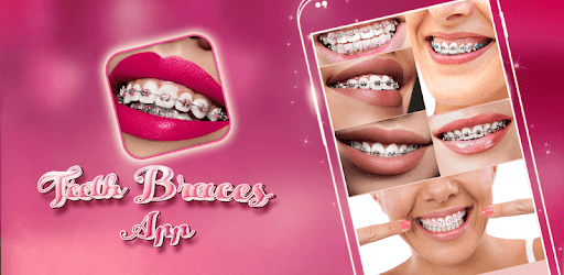 Teeth Braces App PC screenshot Teeth Braces App PC screenshot