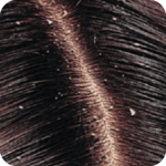 How to Rid Of Dandruff icon