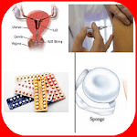 Birth Control Methods for PC Birth Control Methods for PC