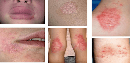 All Skin Infections & Treatments PC screenshot All Skin Infections & Treatments PC screenshot