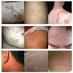 All Skin Infections & Treatments icon