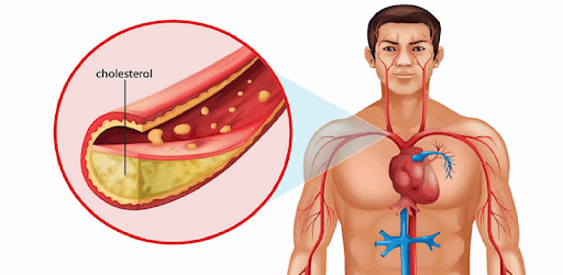 Top Foods That Lowers Cholesterol PC screenshot