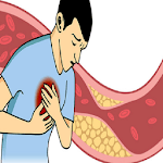 Top Foods That Lowers Cholesterol icon