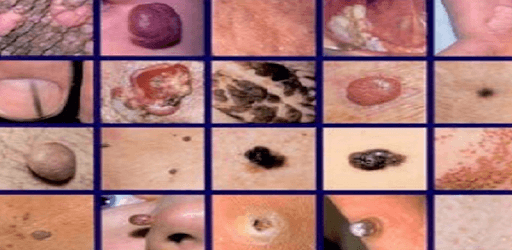 Clinical Dermatology (Colored & Illustrated Atlas) PC screenshot