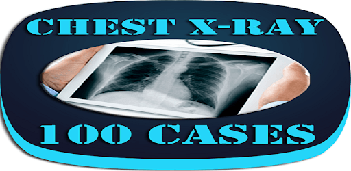 Interpret Chest X-Ray With 100 Cases PC screenshot