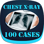 Interpret Chest X-Ray With 100 Cases icon
