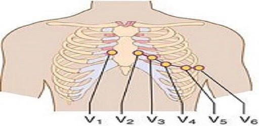 Clinical ECG Guide. PC screenshot