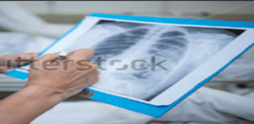Chest X-Ray Based Cases PC screenshot