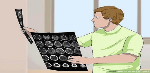 CT Brain Interpretation PC screenshot