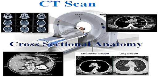 CT Scan Cross Sectional Anatomy PC screenshot