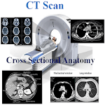 CT Scan Cross Sectional Anatomy icon