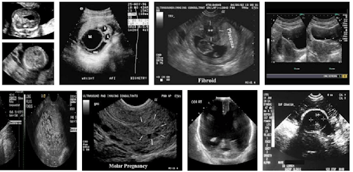 100 Cases in Obstetrics and Gynaecology PC screenshot 100 Cases in Obstetrics and Gynaecology PC screenshot