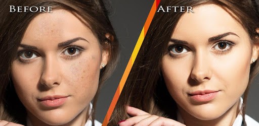 Face Blemishes Removal PC screenshot