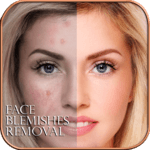 Face Blemishes Removal for PC