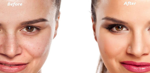 Pimple Eraser Photo Editor PC screenshot