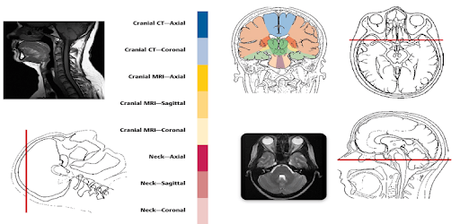 POCKET ATLAS MRI PC screenshot