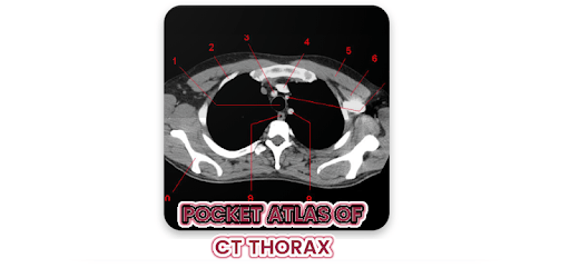 POCKET ATLAS CT THORAX PC screenshot