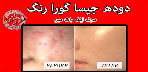 Beauty tips in urdu PC screenshot