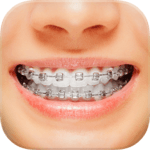 Braces for PC Braces for PC
