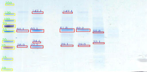 Gelapp: DNA&Prot Gel Analyzer PC screenshot Gelapp: DNA&Prot Gel Analyzer PC screenshot