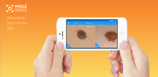 Molexplore “Skin Cancer App” PC screenshot