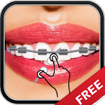 Braces Teeth Camera for PC Braces Teeth Camera for PC