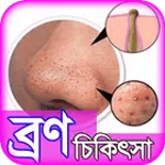 bron dur korar upay or tips ~ for PC