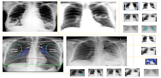 Chest X-Ray And Pathology PC screenshot Chest X-Ray And Pathology PC screenshot