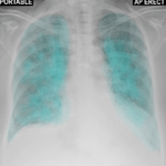 Chest X-Ray And Pathology icon