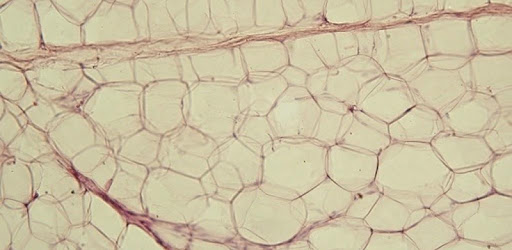 Body tissues PC screenshot