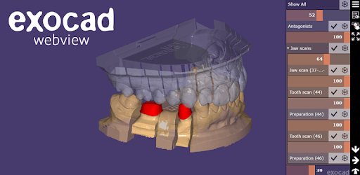exocad webview - Free STL OBJ and 3D Model Viewer PC screenshot