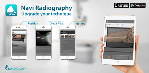 Navi Radiography Lite PC screenshot