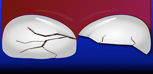 ToothSOS PC screenshot