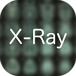 X-Ray Differential Diagnosis for PC