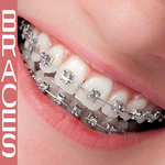 Braces Camera Editor icon