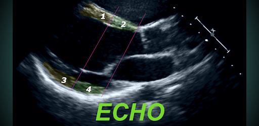 LEARN THE FULL TTE ECHO ULTRASOUND PROTOCOL DEMO PC screenshot LEARN THE FULL TTE ECHO ULTRASOUND PROTOCOL DEMO PC screenshot