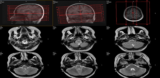 MRI POSITIONING PC screenshot