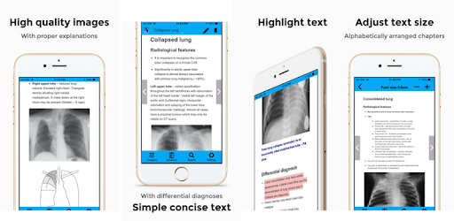 CXR FlashCards - Reference app for Chest X-rays PC screenshot