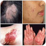All Skin Diseases and Treatment- A to Z icon