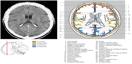 POCKET ATLAS OF CT HEAD PC screenshot