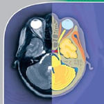 POCKET ATLAS OF CT HEAD icon