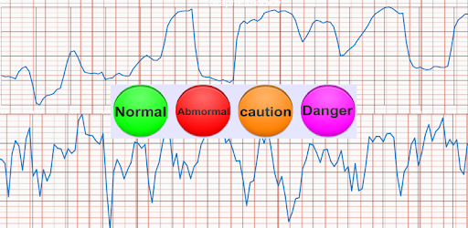 Cardiac diagnosis (heart rate, arrhythmia) PC screenshot