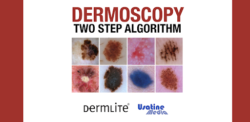 Dermoscopy Two Step Algorithm PC screenshot