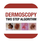 Dermoscopy Two Step Algorithm for PC