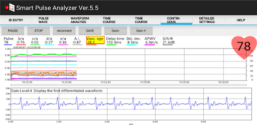 Smart Pulse Analyzer for PC - Free Download & Install on Windows PC, Mac
